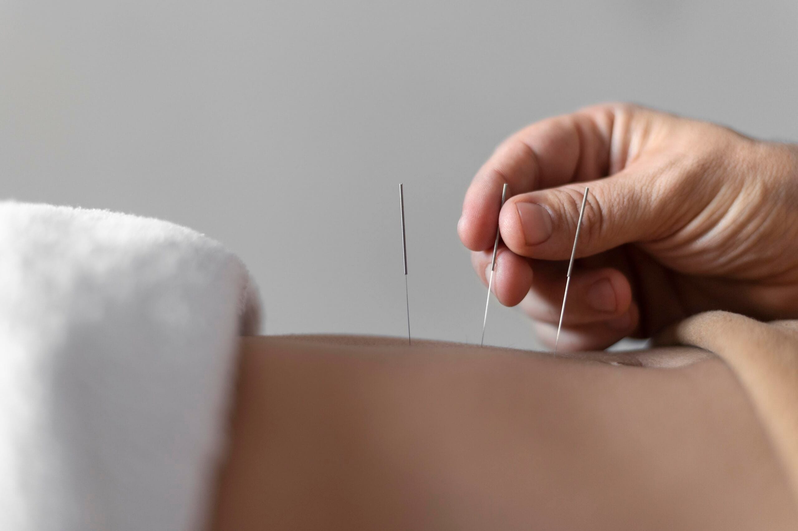 close up hand holding acupuncture needle